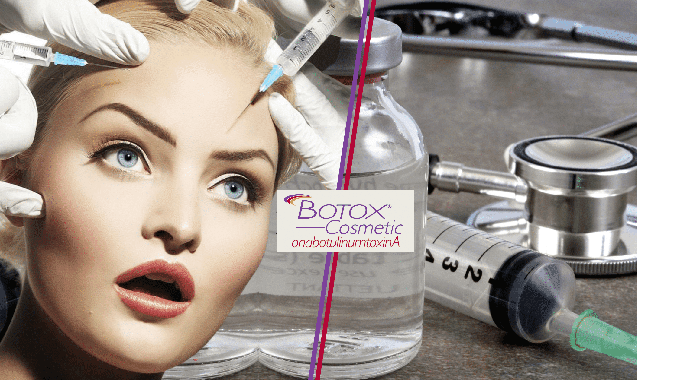 How To Avoid The Frozen Botox Look, By Barbie's Beauty Bits