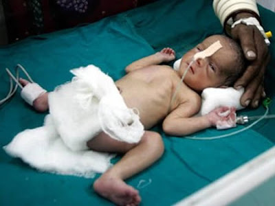 8 Tempat Melahirkan Bayi Paling Aneh Di Dunia!!
