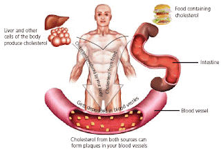 gambar kolesterol