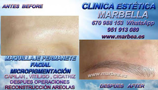 micropigmentyación Fuengirola clínica estetica propone los especial precio para micropigmentyación, maquillaje permanente de cejas en Fuengirola y marbella