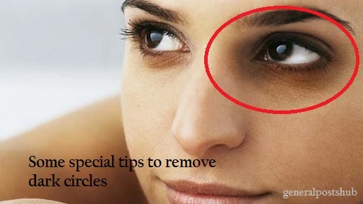 Some special tips to remove dark circles