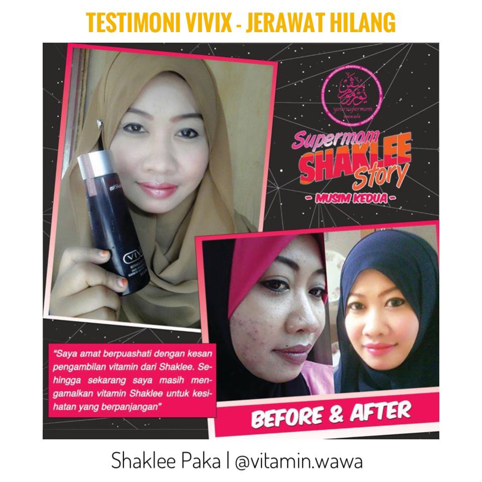 Vivix Shaklee testimoni, vivix Shaklee, vivix Shaklee untuk awet muda, vivix Shaklee untuk jerawat, vivix Shaklee untuk kulit, set awet muda shaklee  kesan awal vivix shaklee kepada kulit  testimoni vivix untuk kulit  cara makan set kecantikan shaklee  shaklee untuk kulit putih  testimoni shaklee  harga set kecantikan shaklee  set cantik Shaklee harga vivix Shaklee vivix shaklee tipu testimoni set kecantikan Shaklee vivix shaklee testimoni set jerawat Shaklee set jerawat shaklee untuk lelaki harga set jerawat Shaklee set jerawat shaklee budget