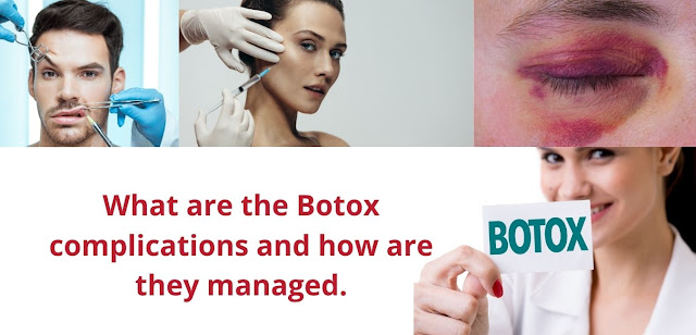 What are the Botox complications and how are they managed.