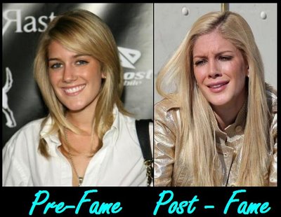 heidi montag after surgery. house heidi montag after