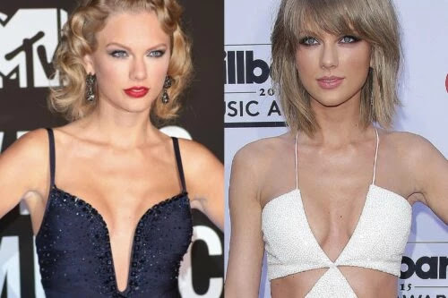 Has Taylor Swift had Cosmetic Surgery?