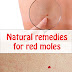Natural Remedies for Red Moles