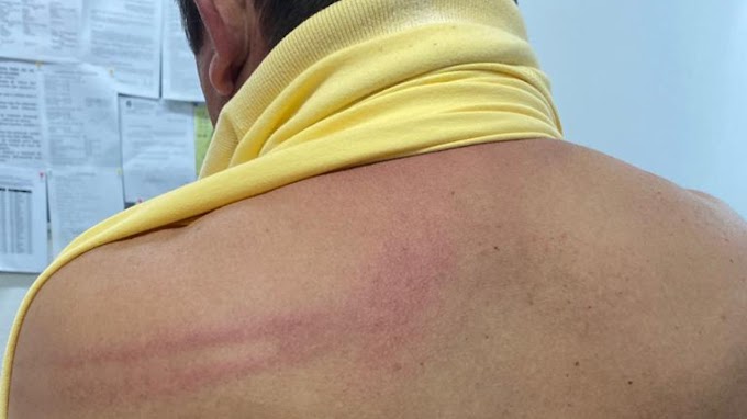 Prefeito de Palhano é agredido por policiais militares durante festa de Carnaval na cidade