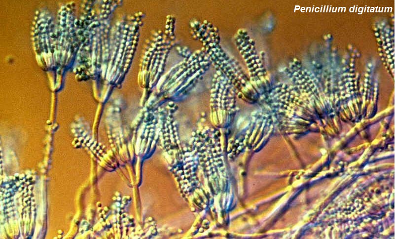  Jamur  Ascomycota Struktur Tubuh Reproduksi dan Contohnya 