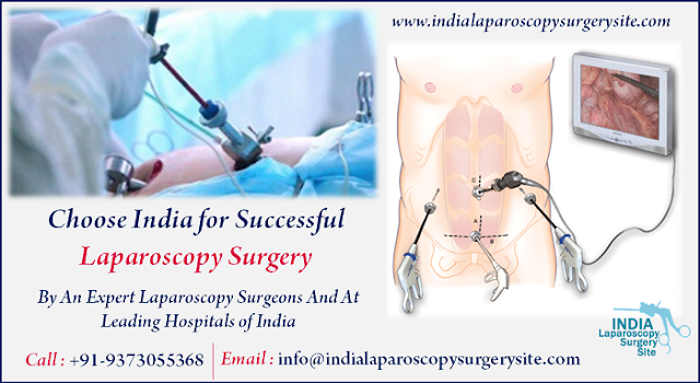 Choose India for Successful Laparoscopy Surgery