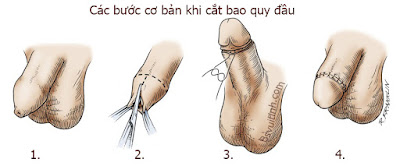 cat-bao-quy-dau