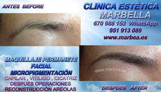 microblading Málaga Clínica Estética Maquillaje Permanente Facial,  Micropigmentación Capilar y microblading cejas Marbella y Málaga: Te ofrecemos la alta calidad de nuestroservicio con los mejores expertos en micropigmentación capilar y microblading cejas