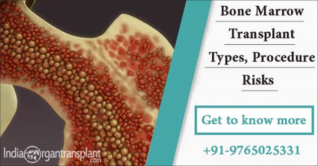 bone marrow transplant procedure