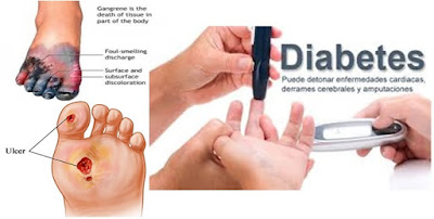 Pengertian Lengkap Penyakit Diabetes