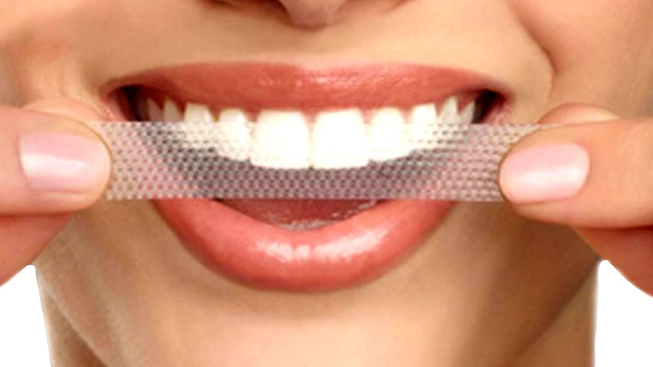 Crest 3d White Professional Effects Teeth Whitening Strips
