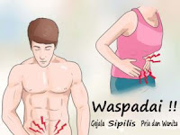 Obat Sipilis Herbal Paling Menyembuhkan