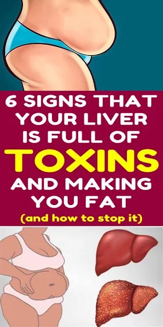 6 Clear Warning Signs Your Liver Is Full Of Toxins And Making You Fat (How to Stop it)