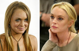Lindsay Lohan  befor and after plastic surgery