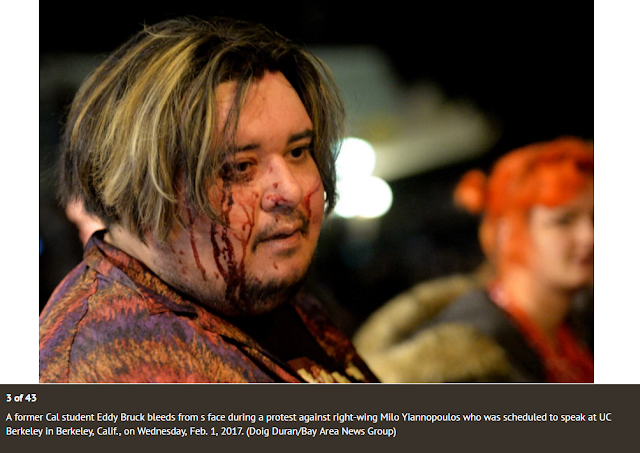 Image of Eddy Bruck after being assaulted by rioters attempting to stop free speech at Berkeley, California, February 1, 2017.