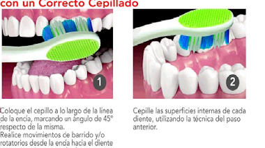 Tecnicas de limpieza dental casera