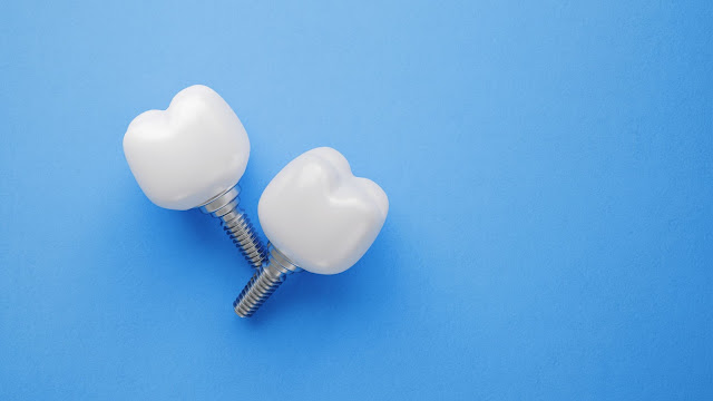 https://www.morganhilldentistry.com/dental-implants-materials-which-one-is-the-best