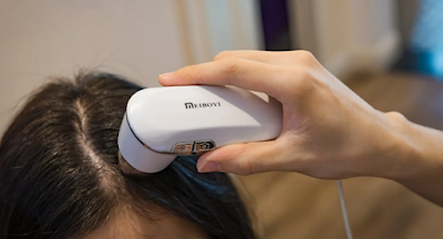 Top Scalp Care Tips for Reducing Dandruff and Stopping the Itch