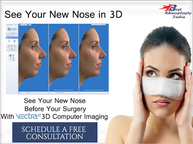 #CosmeticSurgery #Cosmetic #LongNose #Rhinoplasty #HugeNose #SouthDelhi #India #RhinoplastyDelhi #RhinoplastyIndia #Surgery #CosmeticTreatment #GoodLooks #EnhancingLooks #Vectra3D