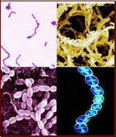 <Img src ="cuadro-bacterias-caries.jpg" width = "200" height "237" border = "0" alt = "Imágenes streptococcus mutans">