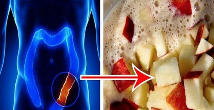 Cleanse 4 Pounds Of Toxins From Your Body With This Wonderful Lemon And Apple Drink