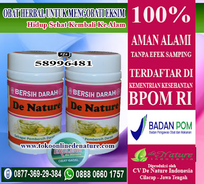 OBAT HERBAL UNTUK MENGOBATI EKSIM