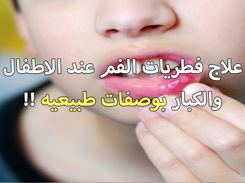 فطريات الفم عند الأطفال وكيفية االعلاج فى المنزل