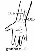 gambar titik pijat titik akupuntur refleksi tangan
