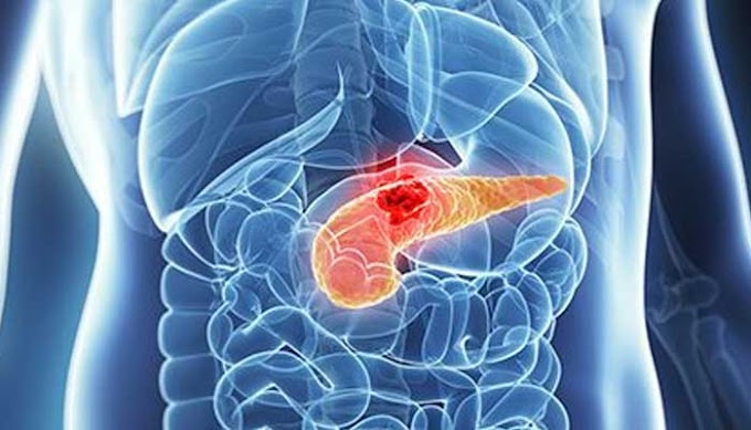 This new medication can treat sorts of pancreatic disease