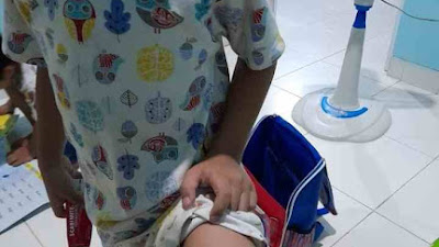 Terulang Lagi Perlakuan Keji Seorang Ibu Sering Aniaya Anak Hingga Luka Lebam Yang Parah..!!