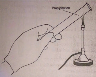 Test for proteinuria, Heat and acetic acid test, Aas, alfaaz-e-aas