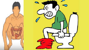 The days of suffering from constipation are over !!!