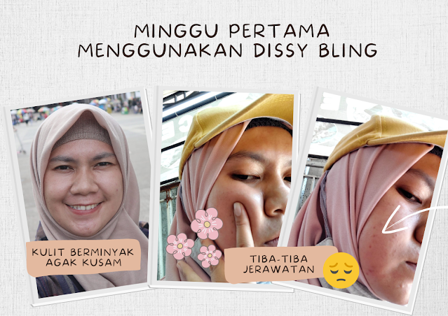 review dissy bling harga dissy bling