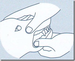 denti