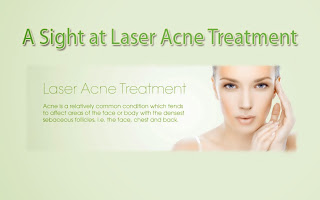 A Look at Laser Acne Therapy