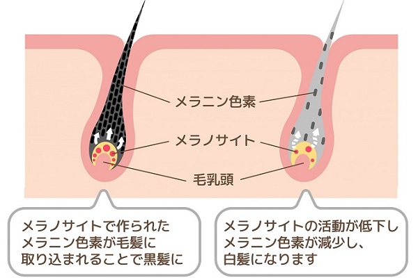 ２４年１月１７日（水）白髪