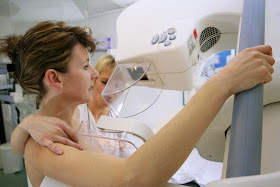 Mammograms after breast reconstruction