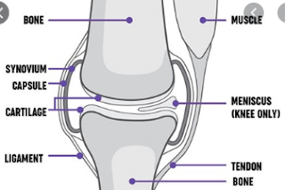 No- evidence- losing- weight- before- knee- surgery beneficial