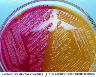 MacConkey-Agar-medium-macconkey-agar-media-preparation-of-macconkey-agar-medium-what-is-macconkey-agar-lactose-and-non-lactose-fermentor-colonies-on-macconkey-agar