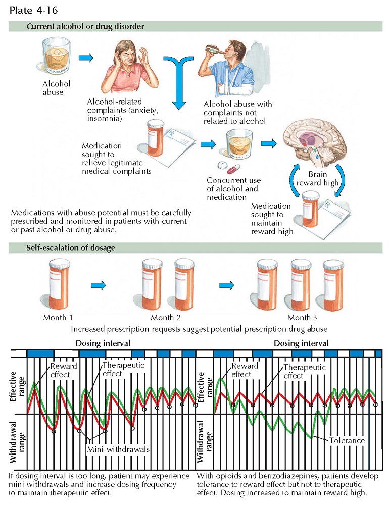 Opioid Use Disorders