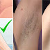 How To Naturally Get Rid Of Unwanted Hair, No Waxing Or Shaving!