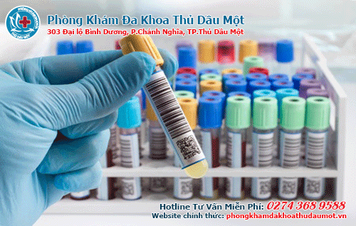 PK Đa khoa Thủ Dầu Một – Nơi xét nghiệm căn bệnh sùi ngoài giờ uy tín