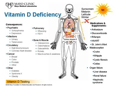 Vitamin D Find Out Why It Is Extremely Important For You