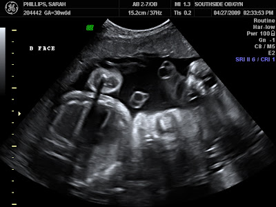 Philips Ultrasonic on The Phillips Family  Ultrasound Appointment