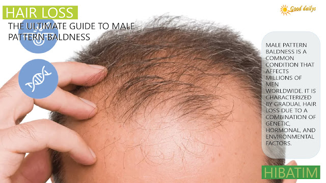 The Ultimate Guide to Male Pattern Baldness: Understanding, Prevention, and Treatment