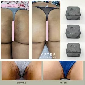 Vagina Whitening Africa Nigeria Handmade Soap Lighten Dark Bikini Line Bamboo Charcoal Cleansing Soap Remove Dullness Skin Care US $3.33 New User Deal 1 sold + Shipping: US $0.68