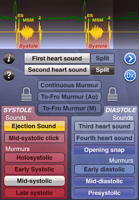 heart sounds murmur ecg